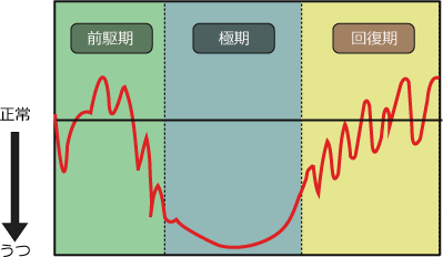 うつ病の症状の経過