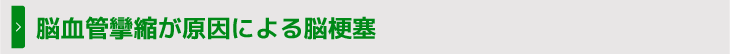 脳血管攣縮が原因による脳梗塞